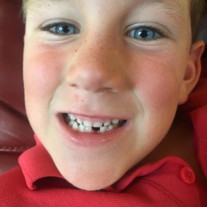 Jake van Workum  poses for the tooth fairy after an encounter with a crisp BERICA apple